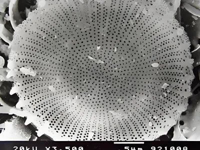 Diatomite microstructure morphology