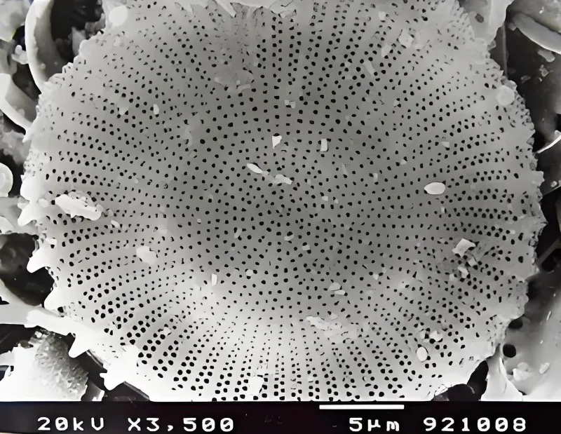 Diatomite microstructure morphology